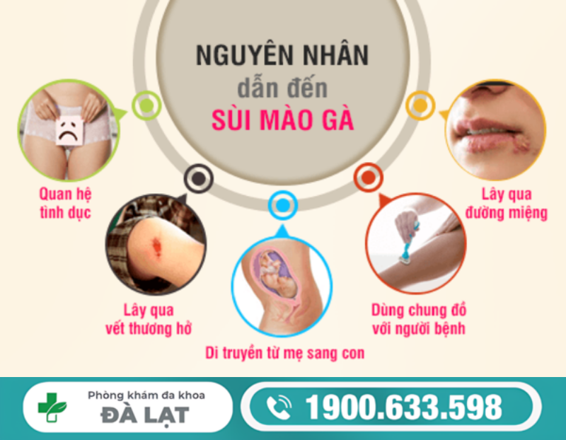 Hình ảnh minh họa